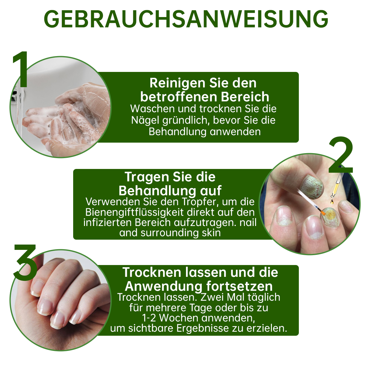 Dobshow™ Bienengift Nagelpilz-Behandlung Liquid🛡️