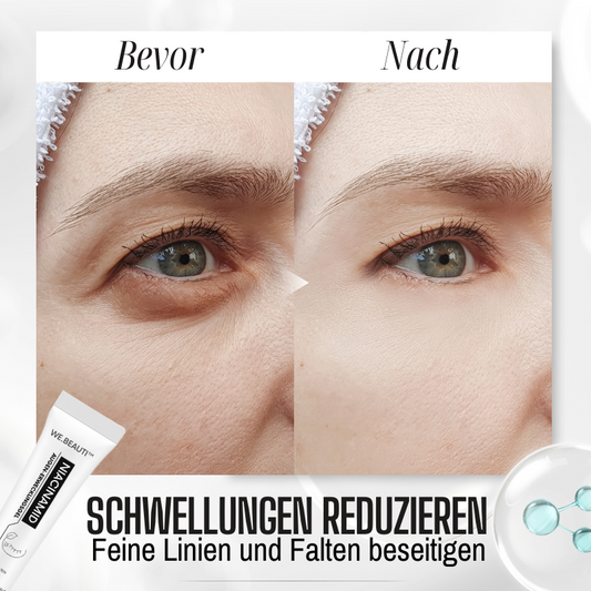 WE.Beauti™  Niacinamid Augenerwachen Gel