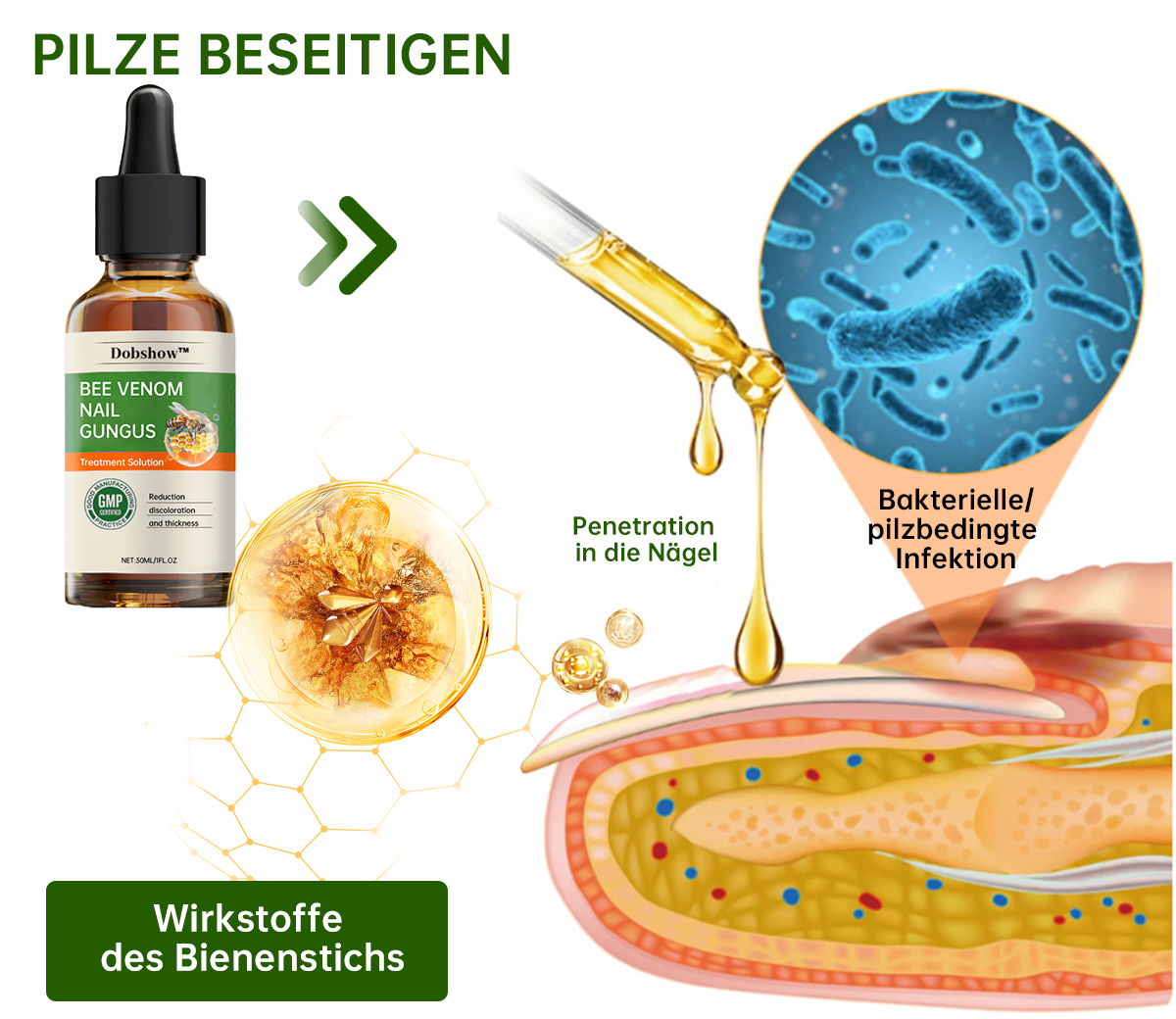 Dobshow™ Bienengift Nagelpilz-Behandlung Liquid🛡️