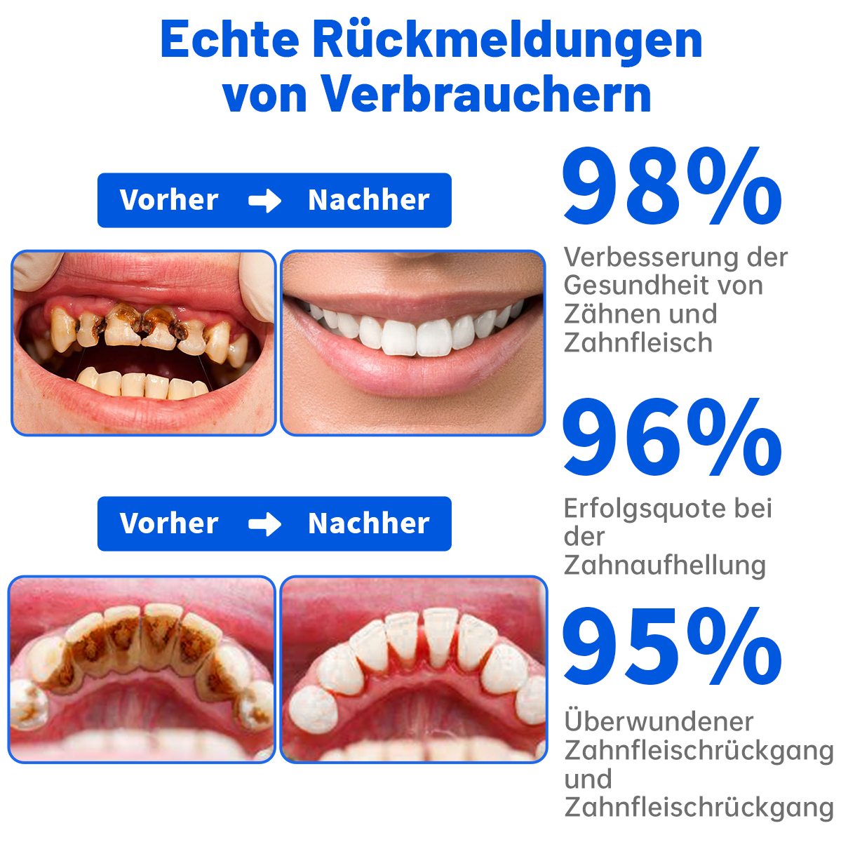 🦷 Dobshow™ SmartSmile Bienengift-Zahnpasta zum Aufhellen und Reparieren